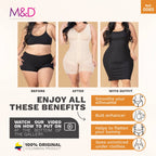 Fajas MyD 0065 beige full-body post-surgery faja colombiana with front hooks, Colombian shapewear before and after comparison