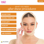 Fajas MyD MYD0810 beige facial compression garment post-surgery faja colombiana for facelift and jaw surgery recovery